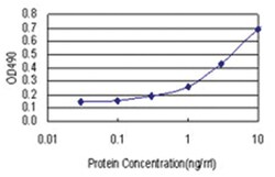 anti-CACNB3 Matched Antibody Pair, Abnova™