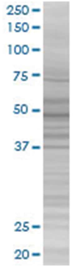 CACNB4 293T Cell Overexpression Lysate (Denatured), Abnova