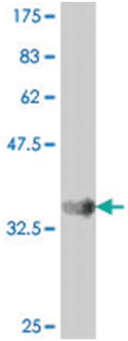 CALCA, Mouse, Polyclonal Antibody, Abnova 50&mu;L; Unlabeled:Antibodies,