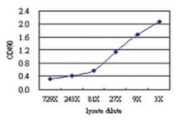 anti-CALCR Matched Antibody Pair, Abnova™