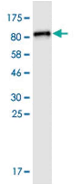 CAMK2B, Mouse, Clone: S13, Abnova 100&mu;g; Unlabeled:Antibodies, Monoclonal