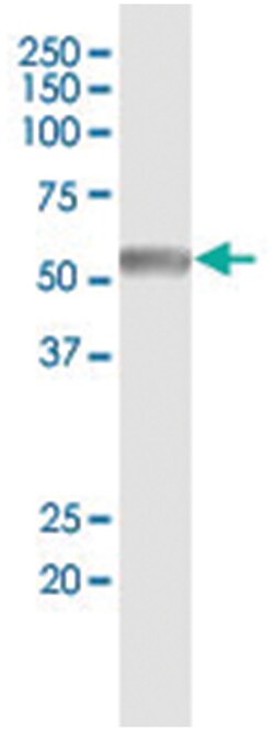 anti-CAMK2B, Human, IP-WB Antibody Pair, Abnova™