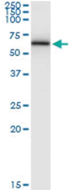 anti-CAMK2G, Human, IP-WB Antibody Pair, Abnova&trade;