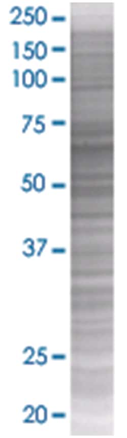 CAMK2G 293T Cell Overexpression Lysate (Denatured), Abnova 100 &mu;L | Buy Online | Abnova | Fisher Scientific