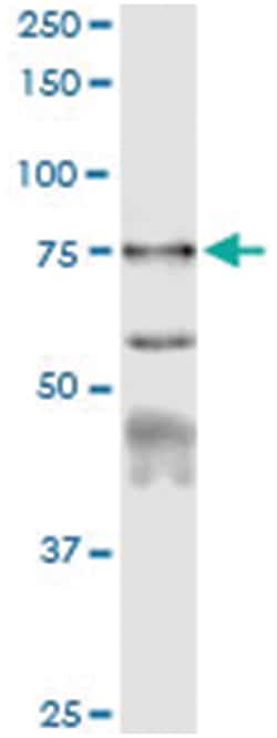 anti-CAPN1, Human, IP-WB Antibody Pair, Abnova&trade;