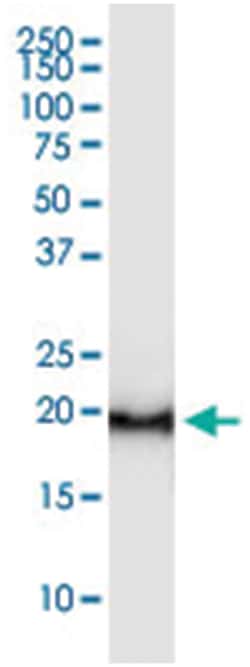 CAPS, Human, IP-WB Antibody Pair (PW2), Abnova&trade;