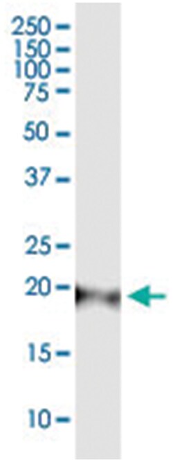CAPS, Human, IP-WB Antibody Pair (PW3), Abnova™
