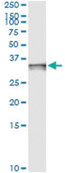 anti-CASP3, Human, IP-WB Antibody Pair, Abnova&trade;