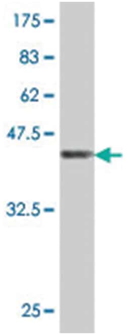CASQ2, Mouse, Polyclonal Antibody, Abnova 50&mu;L; Unlabeled:Antibodies,