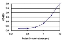 anti-CASQ2 Matched Antibody Pair, Abnova&trade;