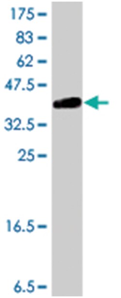RUNX2, Mouse, Polyclonal Antibody, Abnova 50&mu;L; Unlabeled:Antibodies,