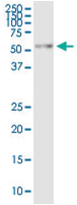 anti-RUNX3, Human, IP-WB Antibody Pair, Abnova 1 Set:Antibodies, Monoclonal/Polyclonal