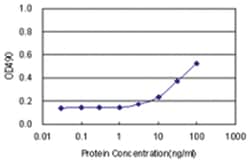 anti-SERPINA6 Matched Antibody Pair, Abnova™