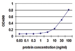 anti-SERPINA6, Human, Matched Antibody Pair, Abnova 1 Set:Antibodies, Monoclonal/Polyclonal