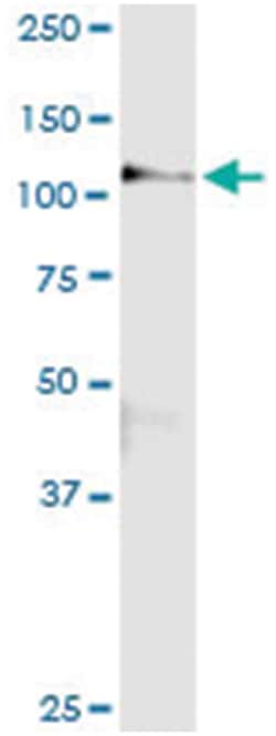 CBL, Human, IP-WB Antibody Pair (PW1), Abnova™