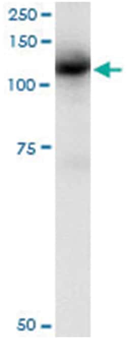 CBL, Human, IP-WB Antibody Pair (PW2), Abnova 1 Set:Antibodies, Monoclonal/Polyclonal