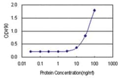 anti-CBR1 Matched Antibody Pair, Abnova&trade;