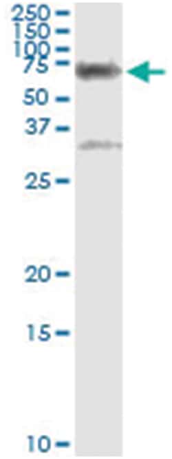 CBS, Human, IP-WB Antibody Pair (PW1), Abnova 1 Set:Antibodies, Monoclonal/Polyclonal
