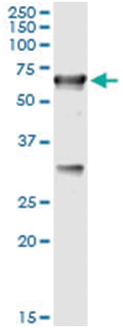 CBS, Human, IP-WB Antibody Pair (PW2), Abnova&trade;