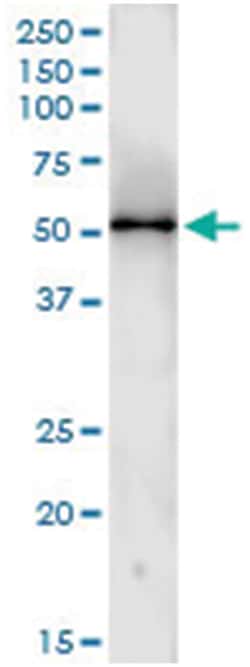 anti-CCNA2, Human, IP-WB Antibody Pair, Abnova&trade;