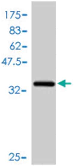 CCND2, Mouse, Polyclonal Antibody, Abnova 50&mu;L; Unlabeled:Antibodies,