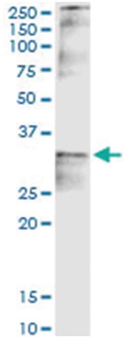 anti-CCND2, Human, IP-WB Antibody Pair, Abnova&trade;
