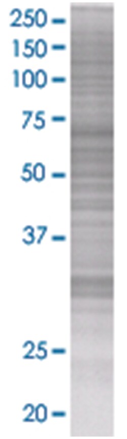 CCND2 293T Cell Overexpression Lysate (Denatured), Abnova 100 &mu;l | Buy Online | Abnova | Fisher Scientific