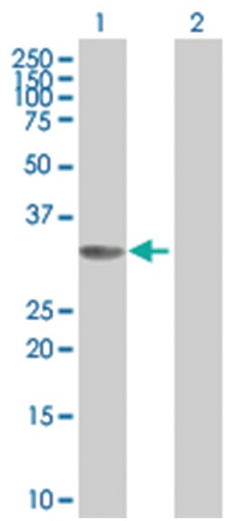CCND2 293T Cell Overexpression Lysate (Denatured), Abnova 100 &mu;l | Buy Online | Abnova | Fisher Scientific
