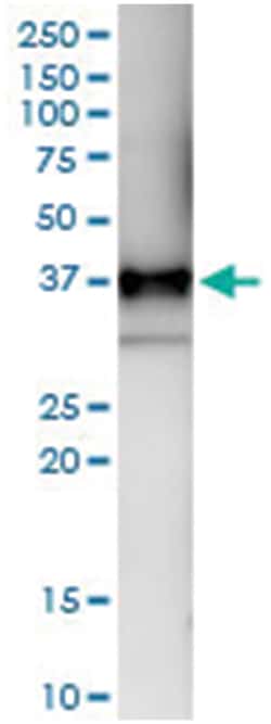 anti-CD1B, Human, IP-WB Antibody Pair, Abnova&trade;