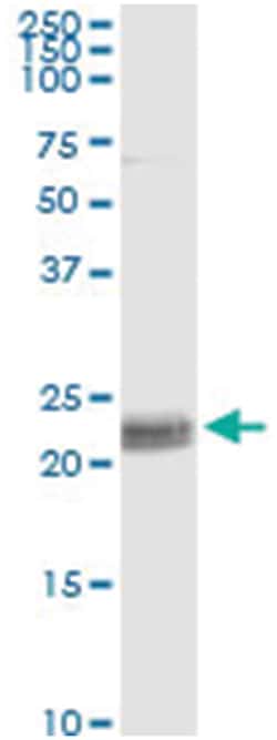 anti-CD8A, Human, IP-WB Antibody Pair, Abnova&trade;