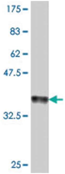 CD8B1, Mouse, Polyclonal Antibody, Abnova 50&mu;L; Unlabeled:Antibodies,
