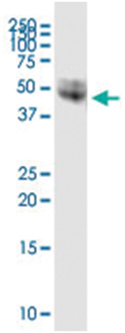 anti-CD14, Human, IP-WB Antibody Pair, Abnova&trade;