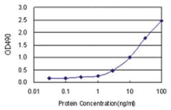 anti-MS4A1 Ab-1 Matched Antibody Pair, Abnova&trade;
