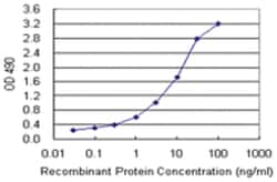 anti-MS4A1, Human, Matched Antibody Pair, Abnova™