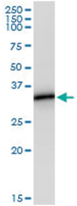 anti-MS4A1, Human, IP-WB Antibody Pair, Abnova™
