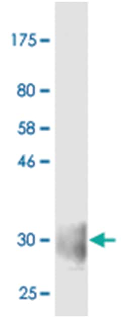 anti-CD28, Clone: 2C1, Abnova 100 &mu;g | Buy Online | Abnova | Fisher Scientific