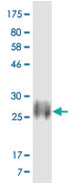 anti-CD28, Clone: 1H3, Abnova 100 &mu;g | Buy Online | Abnova Corporation | Fisher Scientific