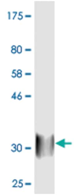 anti-CD28, Clone: 1E5., Abnova 100 &mu;g | Buy Online | Abnova | Fisher Scientific
