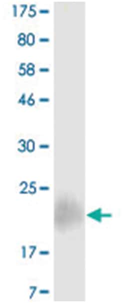 anti-CD28, Clone: 1D7, Abnova 100 &mu;g | Buy Online | Abnova | Fisher Scientific