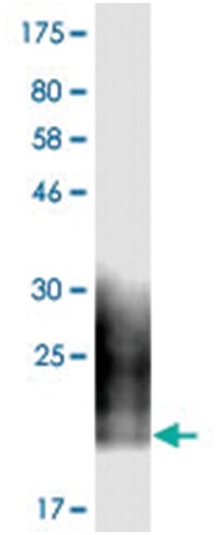 anti-CD80, Clone: 7E6., Abnova 100 &mu;g | Buy Online | Abnova Corporation | Fisher Scientific