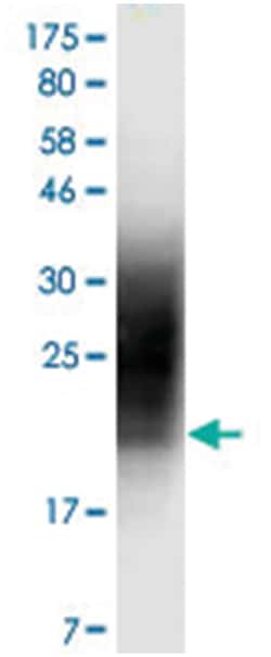 anti-CD80, Clone: 7D3, Abnova 100 &mu;g | Buy Online | Abnova Corporation | Fisher Scientific
