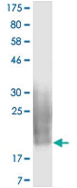 anti-CD80, Clone: 5F5, Abnova 100 &mu;g | Buy Online | Abnova Corporation | Fisher Scientific