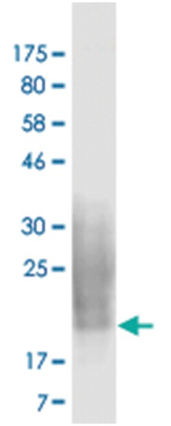 anti-CD80, Clone: 6G6, Abnova 100 &mu;g | Buy Online | Abnova Corporation | Fisher Scientific