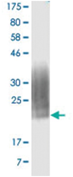 anti-CD80, Clone: 5H6, Abnova 100 &mu;g | Buy Online | Abnova Corporation | Fisher Scientific