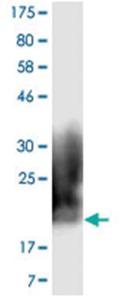 anti-CD80, Clone: 5C8, Abnova 100&mu;g, Unlabeled:Anticuerpos