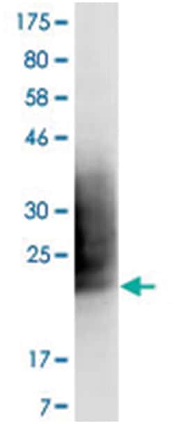 anti-CD80, Clone: 8E10., Abnova 100 &mu;g | Buy Online | Abnova Corporation | Fisher Scientific