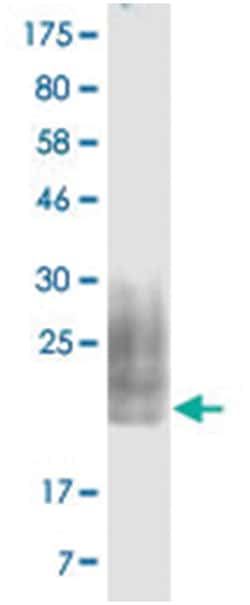 anti-CD80, Clone: 5G4, Abnova 100 &mu;g | Buy Online | Abnova Corporation | Fisher Scientific