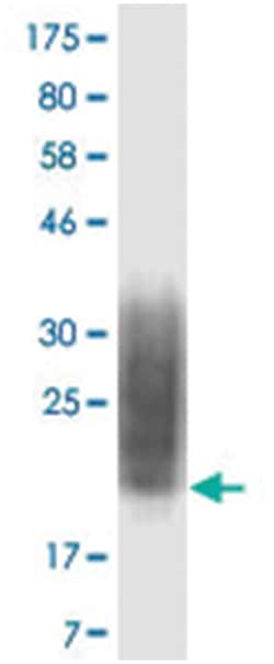 anti-CD80, Clone: 5B12, Abnova 100&mu;g, Unlabeled:Anticuerpos