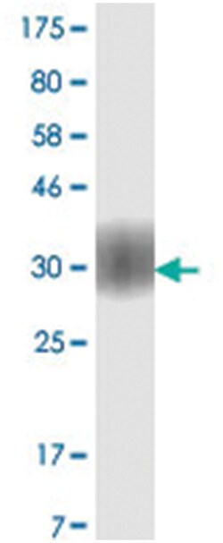 anti-CD80, Clone: 3E5., Abnova 100 &mu;g | Buy Online | Abnova Corporation | Fisher Scientific