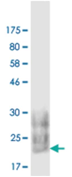 anti-CD80, Clone: 8D11, Abnova 100 &mu;g | Buy Online | Abnova Corporation | Fisher Scientific